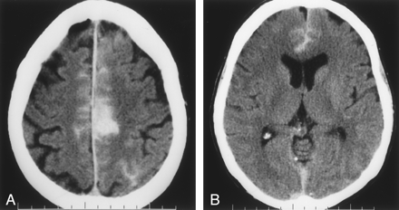 Fig 1.