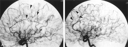 Fig 3.