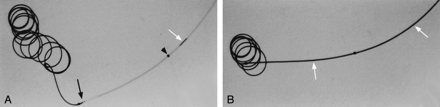 Fig 3.