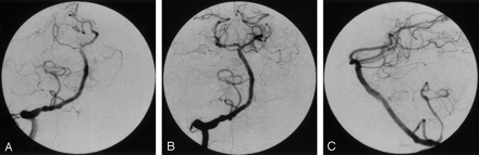 Fig 2.