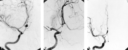 Fig 1.