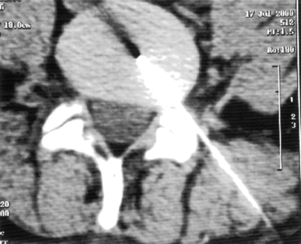 Fig 1.