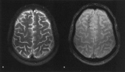 Fig 2.