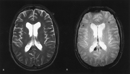 Fig 4.