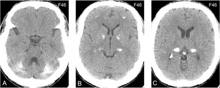 Fig 4.