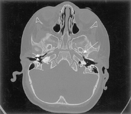 Fig 1.