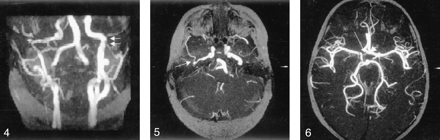 Fig 4.