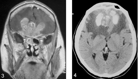 Fig 3.