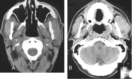 Fig 1.