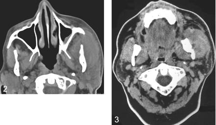 Fig 3.