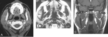 Fig 5.