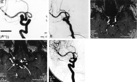 Fig 3.