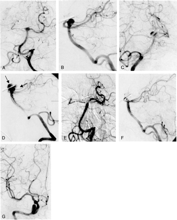 Fig 5.