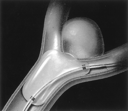 Fig 1.