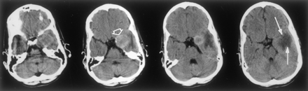 Fig 2.