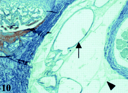 Fig 10.