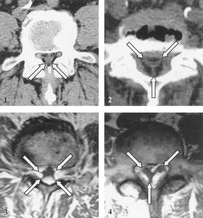Fig 4.