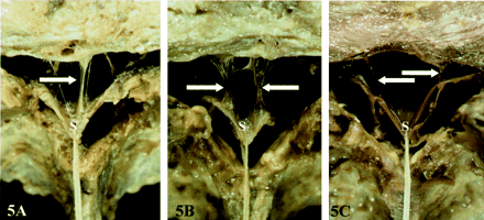 Fig 5.