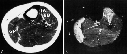 Fig 3.