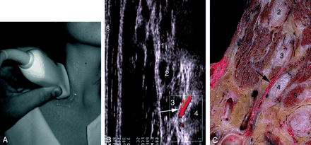 Fig 3.