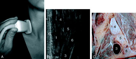Fig 5.