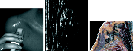 Fig 8.