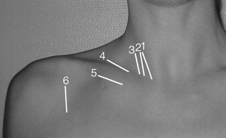 Fig 9.