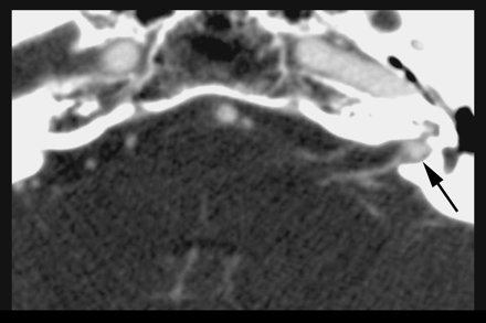 Fig 2.