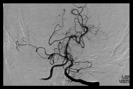 Fig 3.
