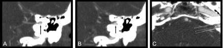 Fig 4.