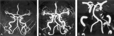 Fig 1.