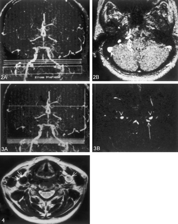 Fig 3.