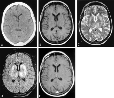 Fig 1.