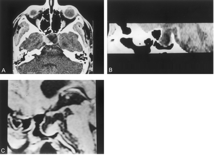 Fig 1.
