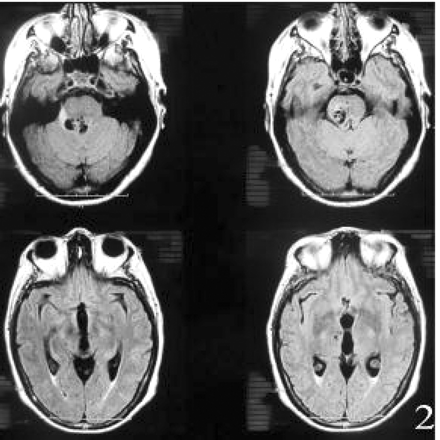 Fig 2.