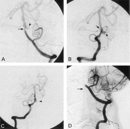 Fig 2.
