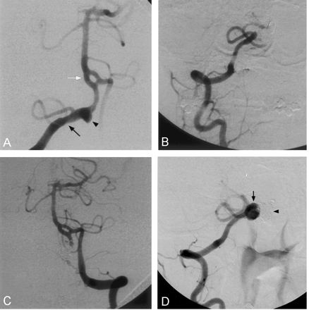 Fig 4.