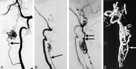 Fig 4.