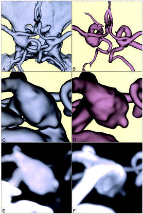 Fig 2.