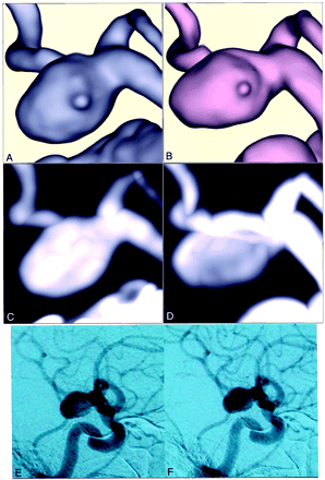 Fig 3.