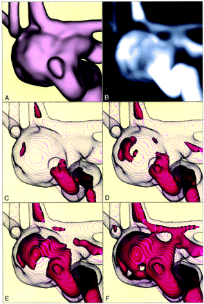Fig 4.