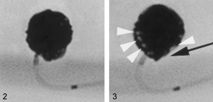 Fig 2.