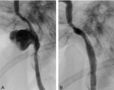 Fig 2.
