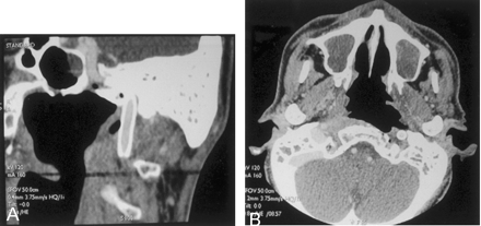 Fig 3.