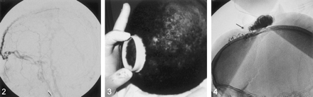 Fig 2.