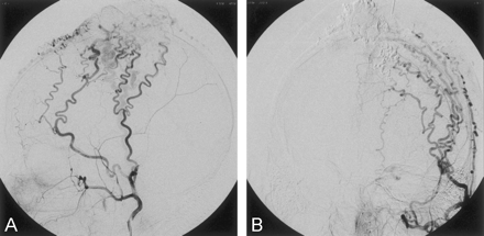 Fig 5.