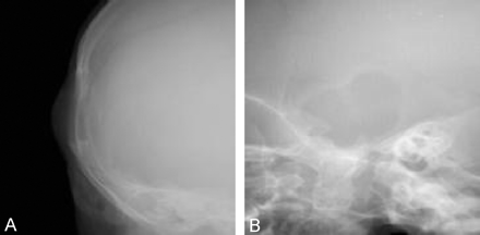 Fig 1.