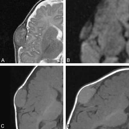 Fig 3.