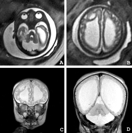 Fig 1.