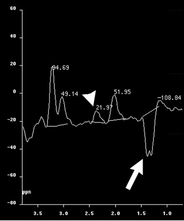 Fig 2.